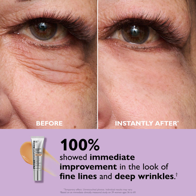 Peter Thomas Roth Instant FirmX Eye Temporary Eye Tightner Easy-Wear Formula Eye Cream