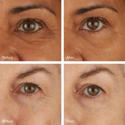Skyn Iceland Hydro Cool Firming Eye Gels Eye Masks   