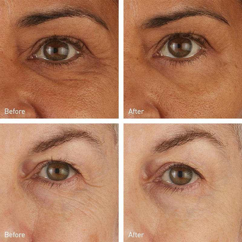 Skyn Iceland Hydro Cool Firming Eye Gels Eye Masks   