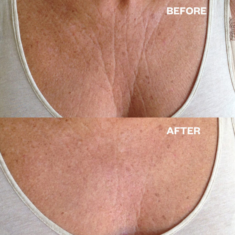 Wrinkles Schminkles Chest Wrinkle Patch Neck Masks   