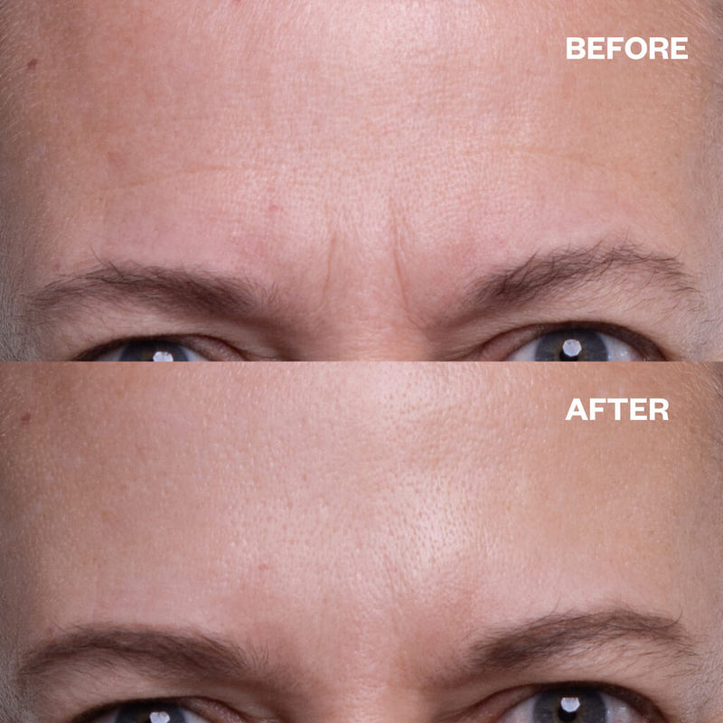 Wrinkles Schminkles Forehead Wrinkle Patches - 2 Patches Face Masks   