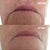 Wrinkles Schminkles Mouth & Lip Wrinkle Patches - 2 Patches Face Masks   