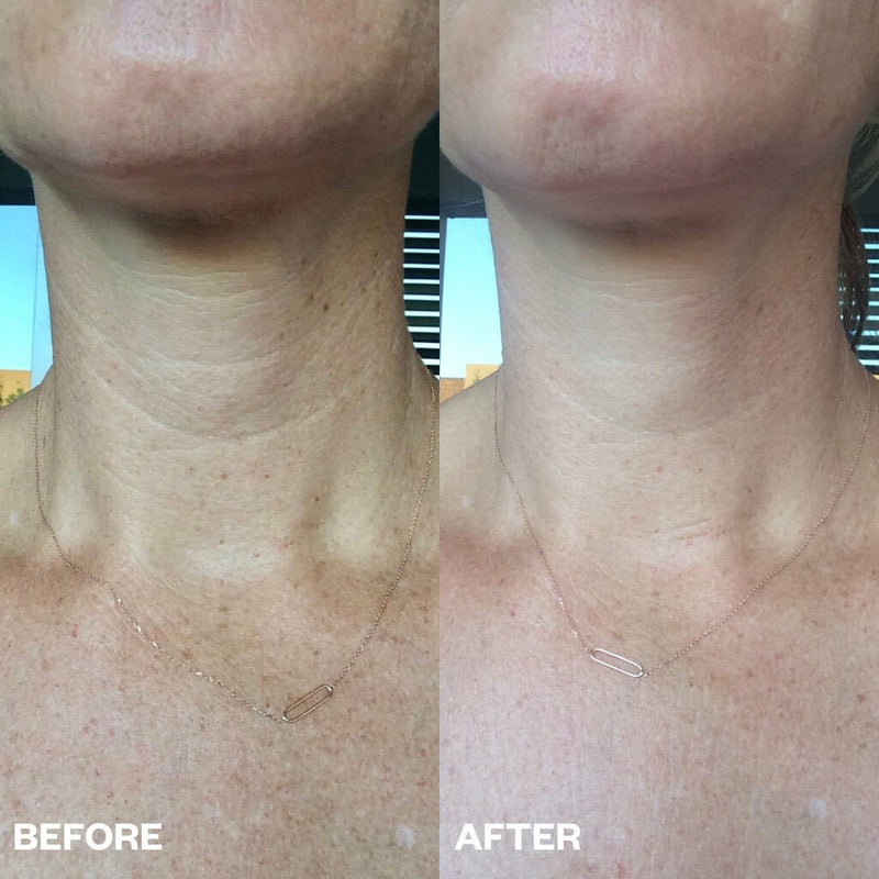 Wrinkles Schminkles Neck Wrinkle Patch Neck Masks   