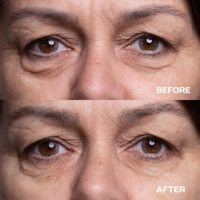 Wrinkles Schminkles Eye Wrinkle Patches - 3 Pairs Eye Masks   