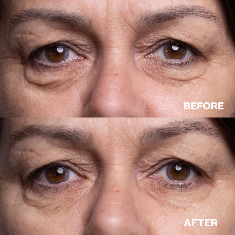 Wrinkles Schminkles Eye Wrinkle Patches - 3 Pairs Eye Masks   