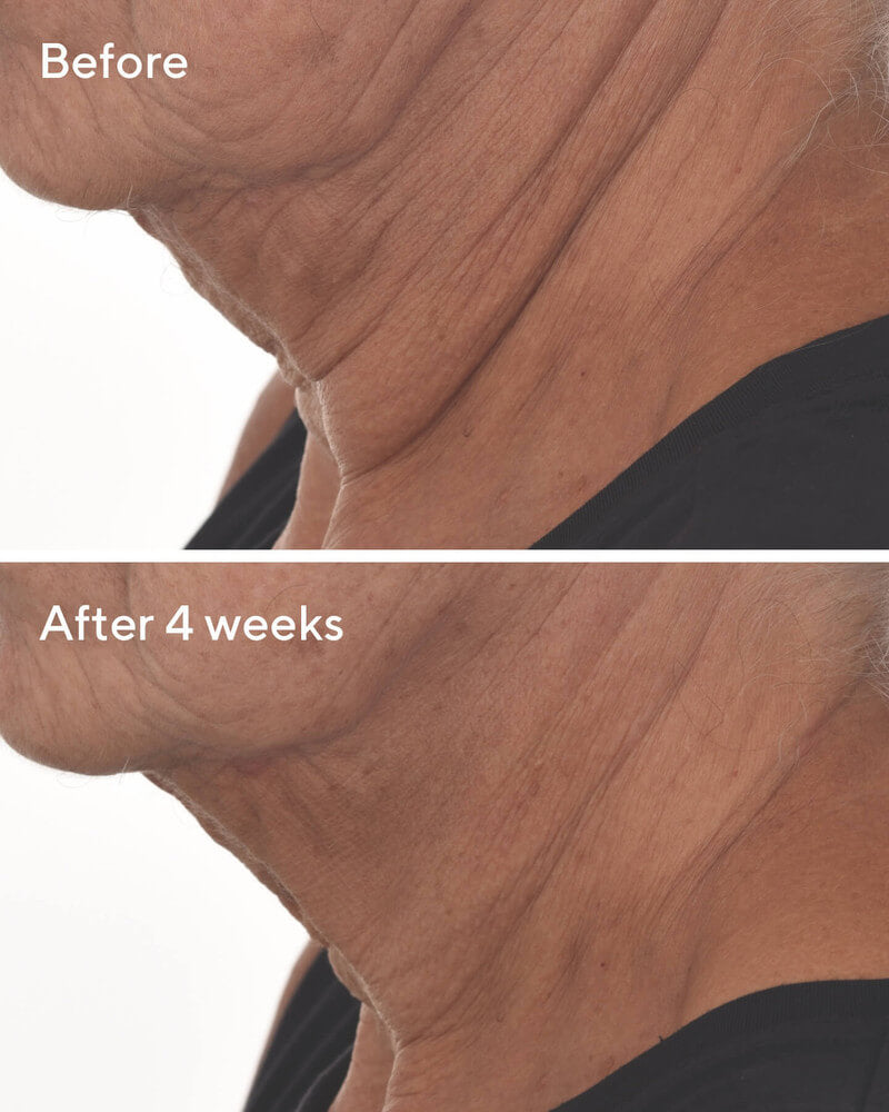 Murad Retinal ReSculpt Overnight Treatment Instant Face Treatments   