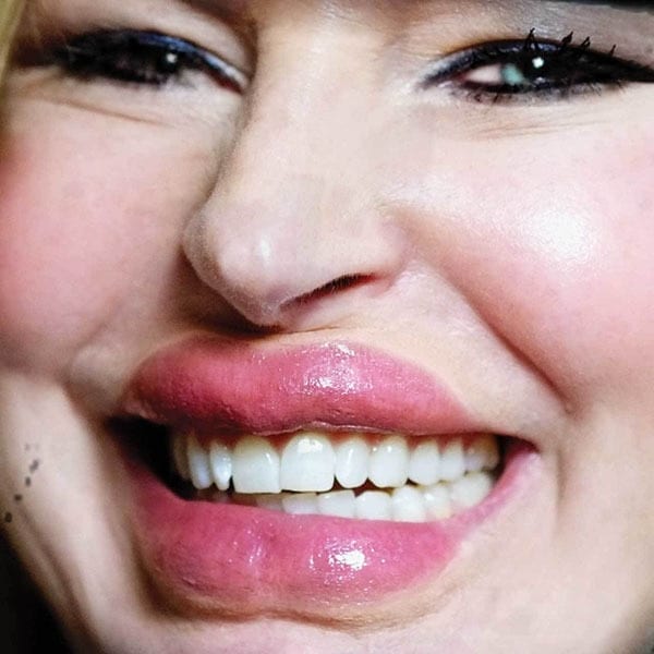 Tinsley Transfers Lip/Tuck - 3D FX Transfer Prosthetic Transfers   